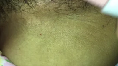裸天